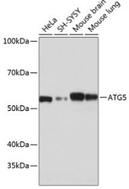 Антитела [KO Validated] ATG5 кроличьи, моноклональные, ABclonal, Китай